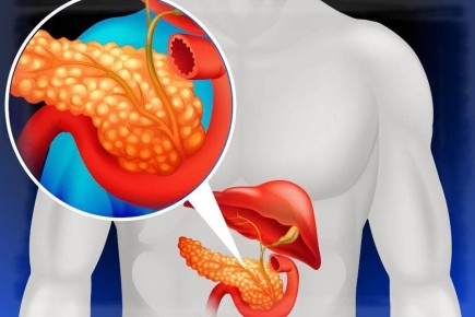 ��� �������� �������� ������������� ������: ������� � ����������� ������