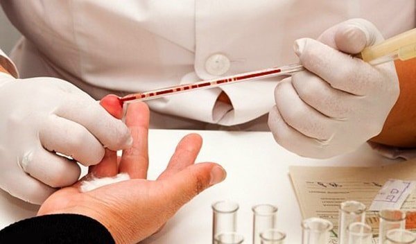 Клинический анализ крови: что он рассказывает о вашем здоровье