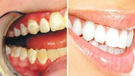 ������ � �������� �����: �������� ���� ������ ������